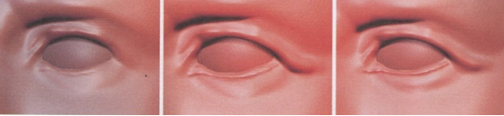 zbrush实例教程：老人头部细节刻画（一）明确大结构、雕刻眼部皱纹
