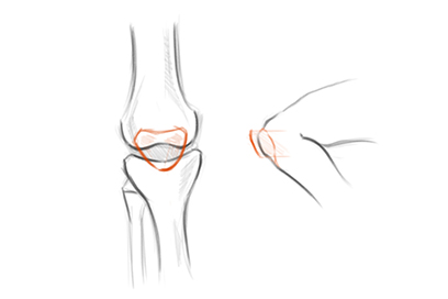 膝盖骨结构概括02.jpg