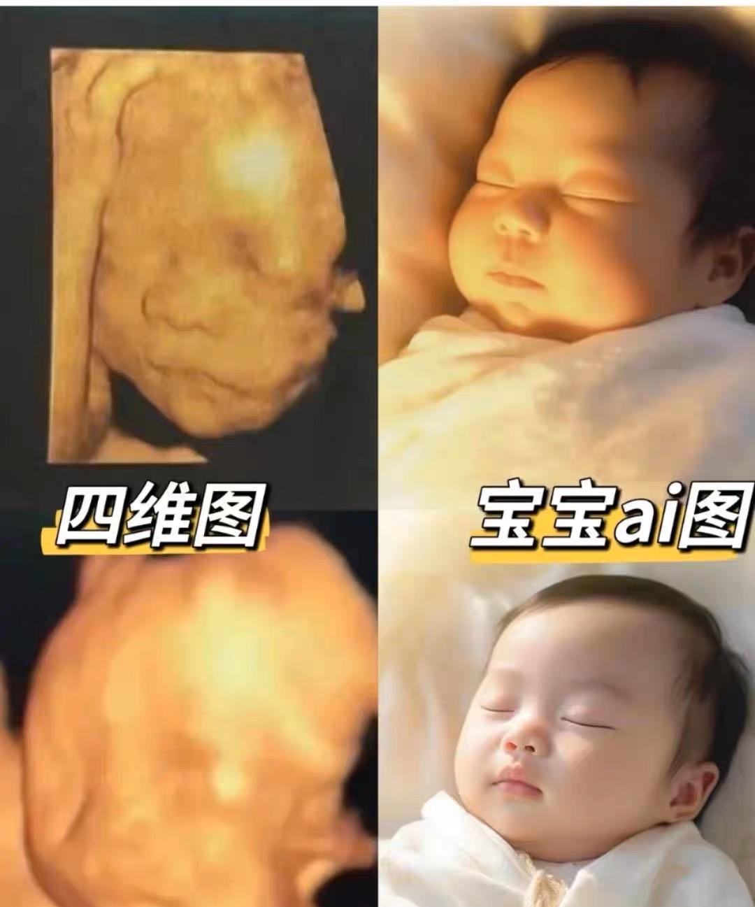 AI四维产检彩超预测图